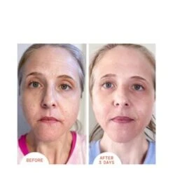 Dr Dennis Gross Alpha Beta Peel Extra Strength 19 Dr Dennis Gross Alpha Beta Peel Extra Strength -Babor Store Alpha Beta Peel Extra Strength add2 26579 3958 general