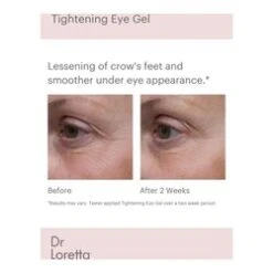 Dr Loretta Tightening Eye Gel 8 Dr Loretta Tightening Eye Gel -Babor Store Tightening Eye Gel add2 56316 5251 general