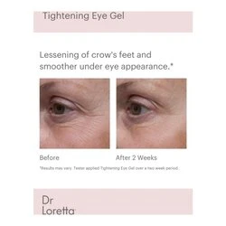 Dr Loretta Tightening Eye Gel 5 Dr Loretta Tightening Eye Gel - Image 3